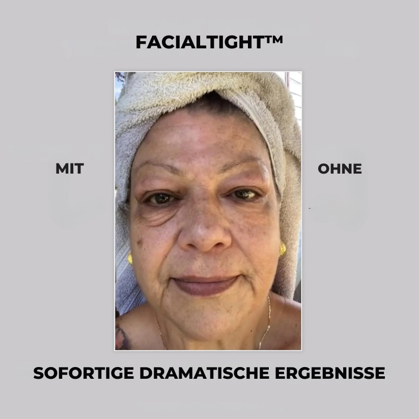 FacialTight™ | 1+1 GRATIS!